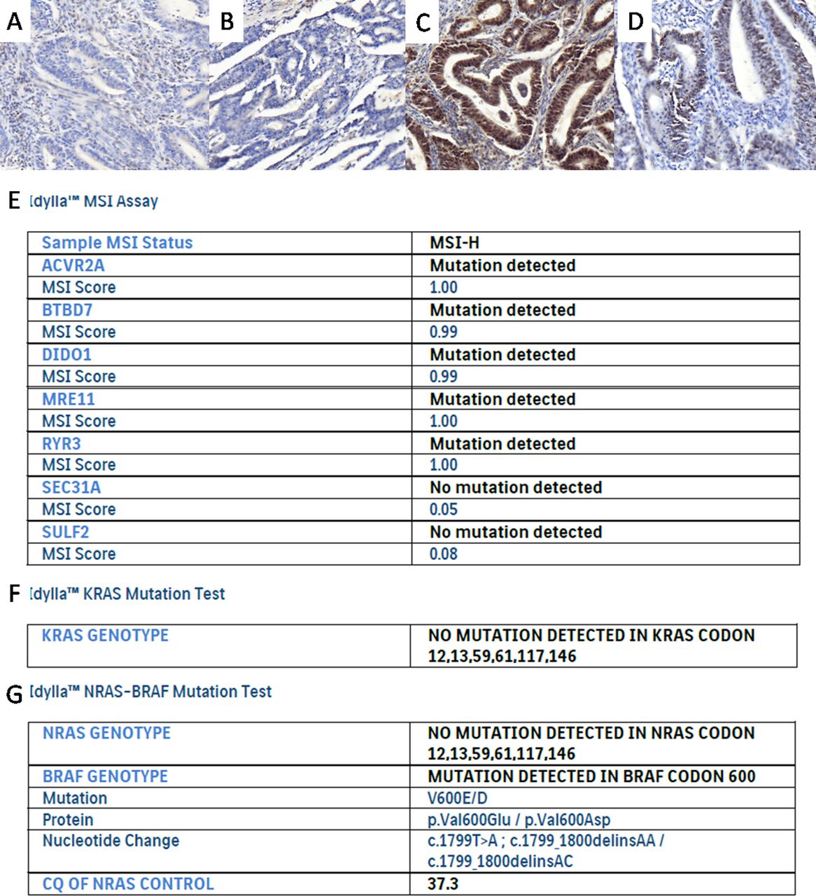Evaluation of KRAS, NRAS and BRAF mutational status and microsatellite ...